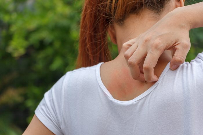 Women scratching itching back