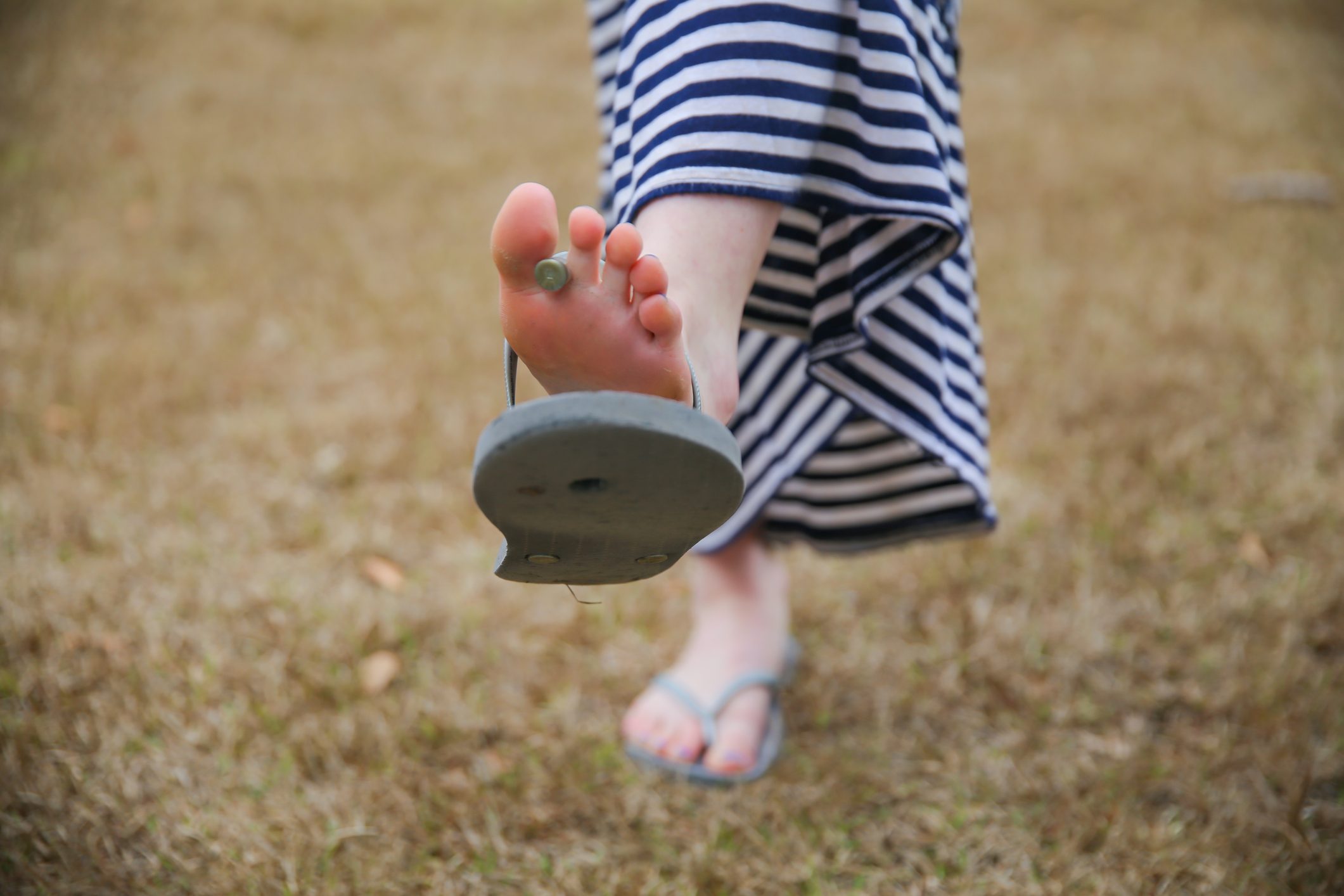 woman wearing broken flip flop