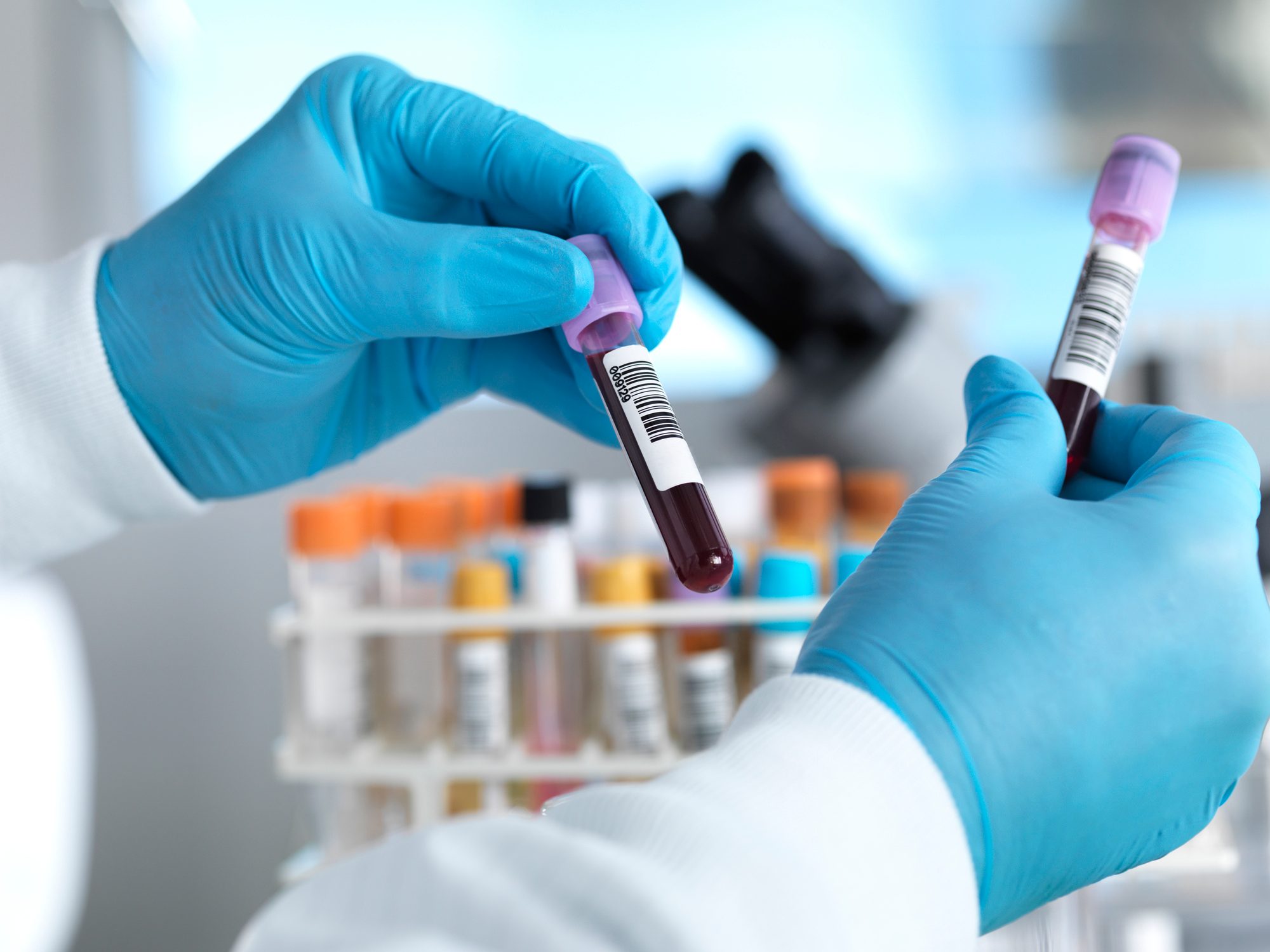 hands holding blood samples in laboratory