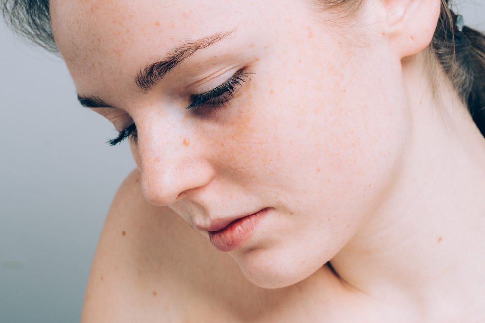 Young beautiful freckles woman face portrait with healthy skin
