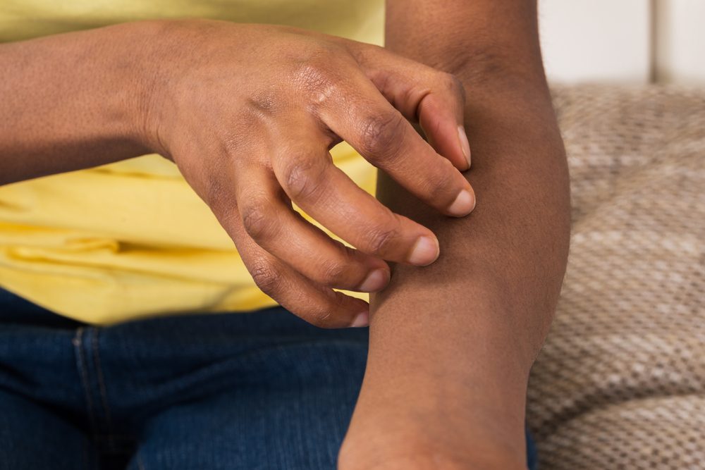 Close-up Of A African Woman Suffering From Itching