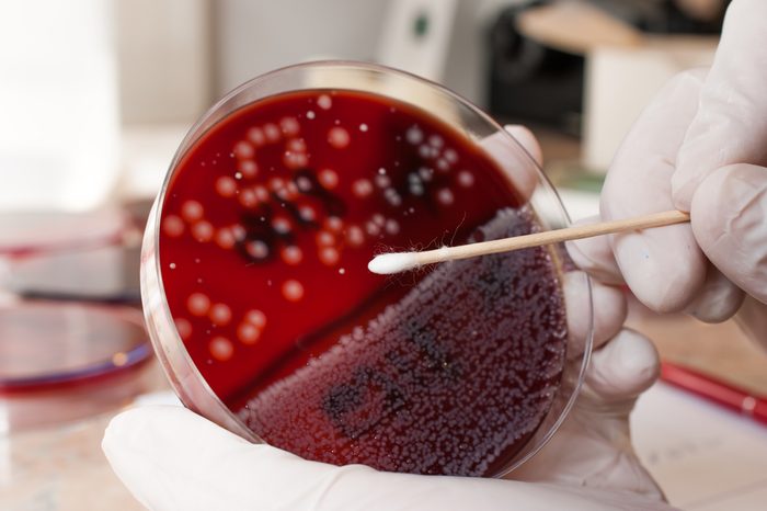 Laboratory doctor holding sterile swab and petri dish 