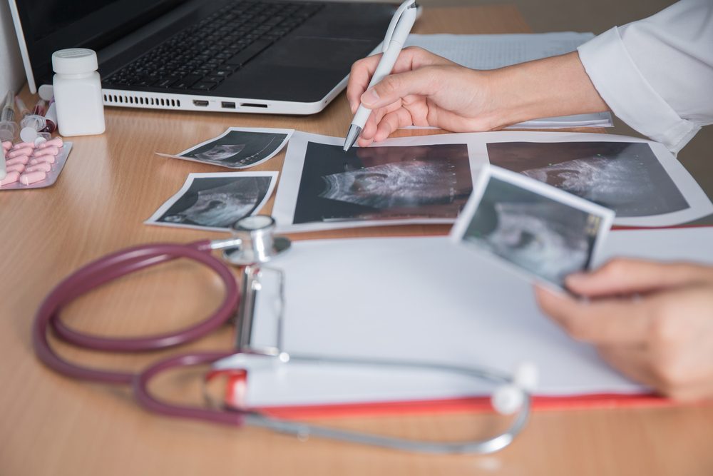 Doctor holding ultrasound pregnant on working table in the hospital.