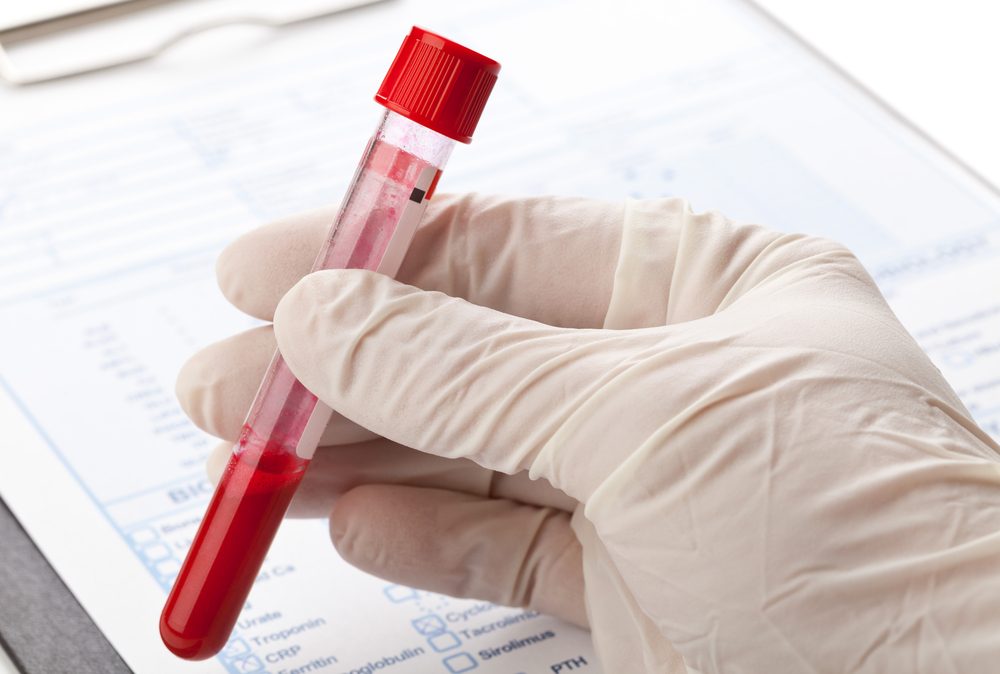 Hand with latex glove holding blood sample vial in front of blood test form