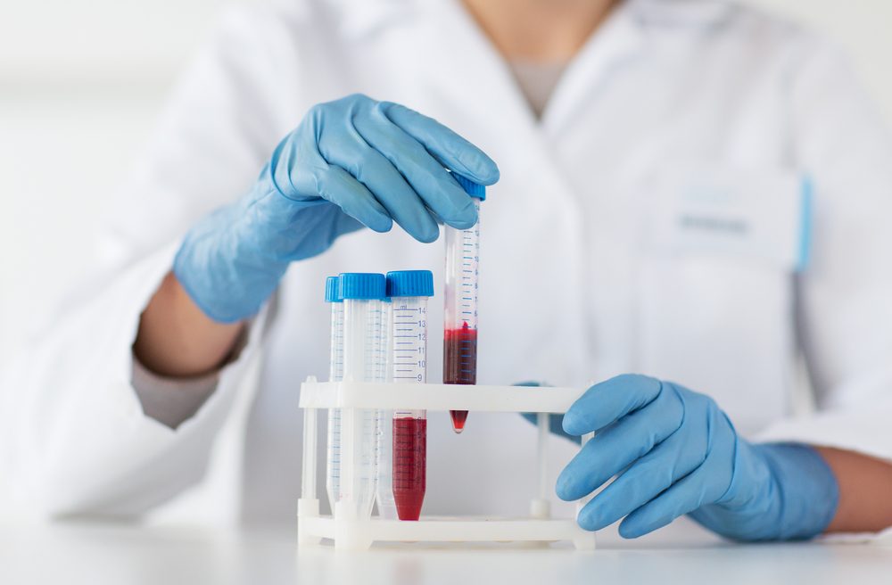 science, chemistry, biology, medicine and people concept - close up of young female scientist holding tube with blood sample making and test or research in clinical laboratory