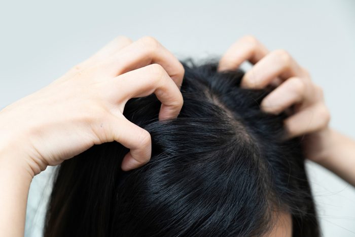 close-up on woman hand scratching her itchyhead and hair