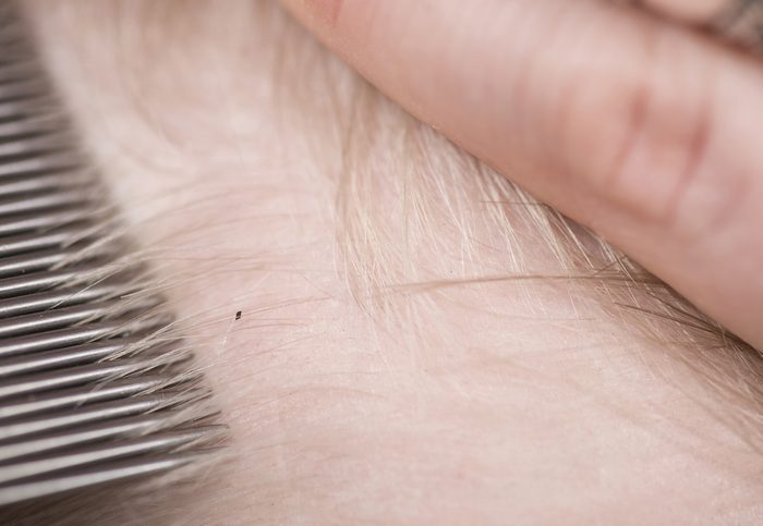 Mother checking childs head for lice with a comb