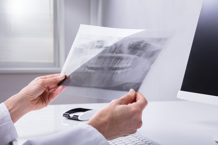 Dentist's Hand Holding Teeth X-ray