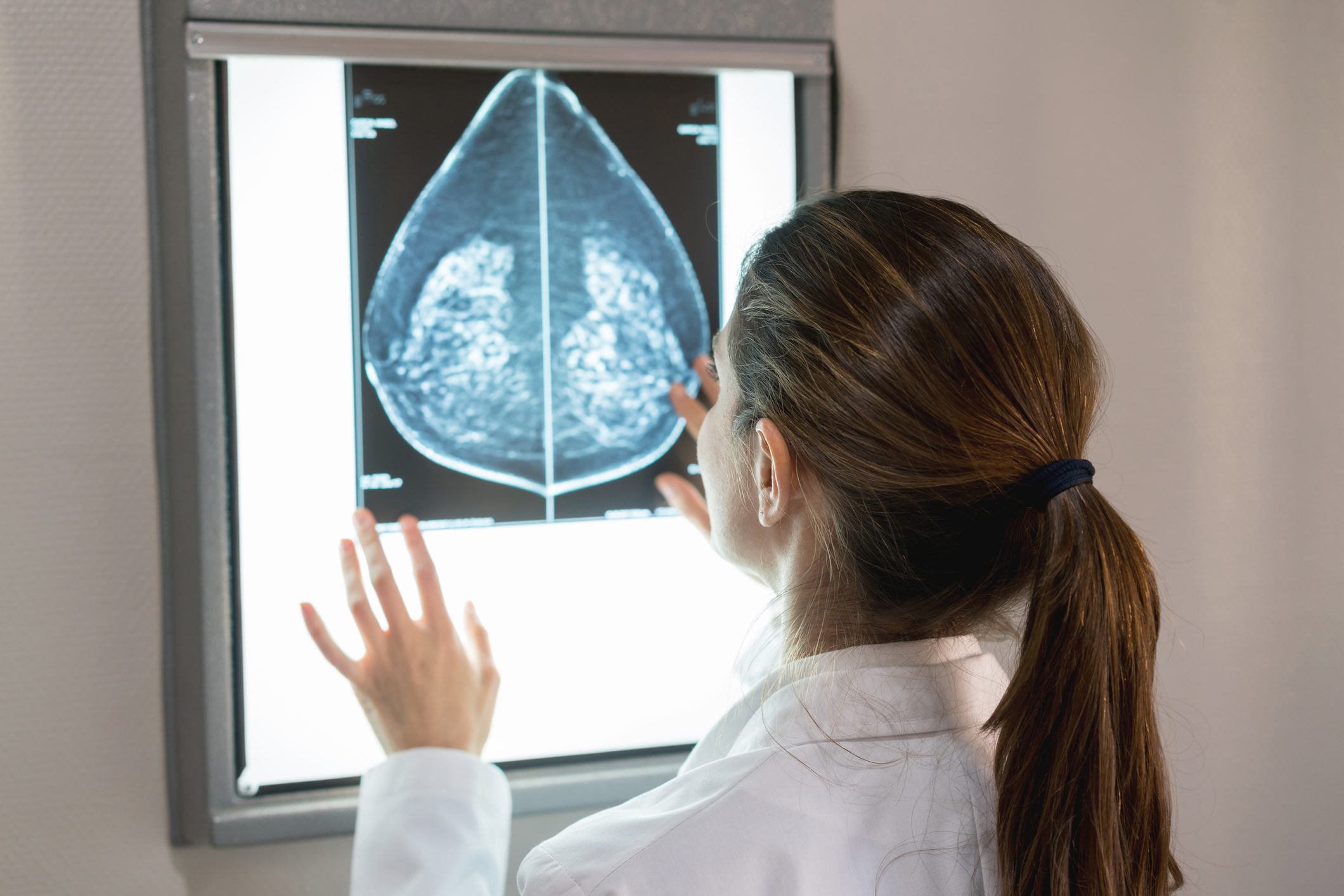 doctor examining mammogram results