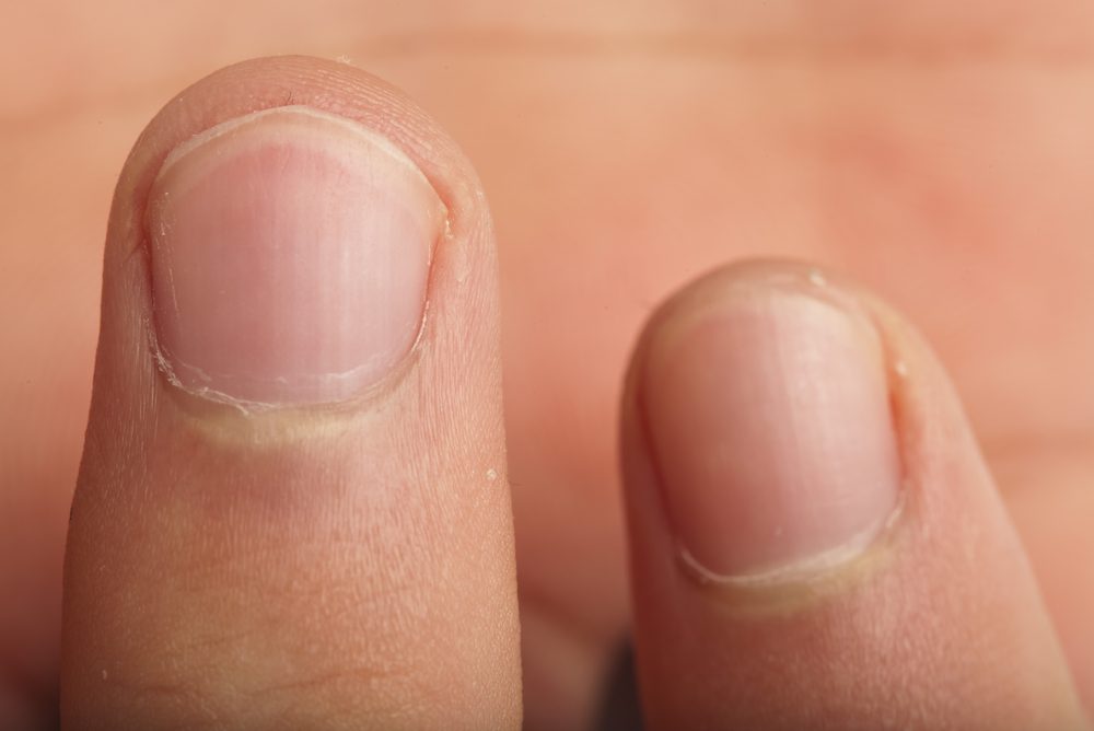 extreme closeup of a male finger detail