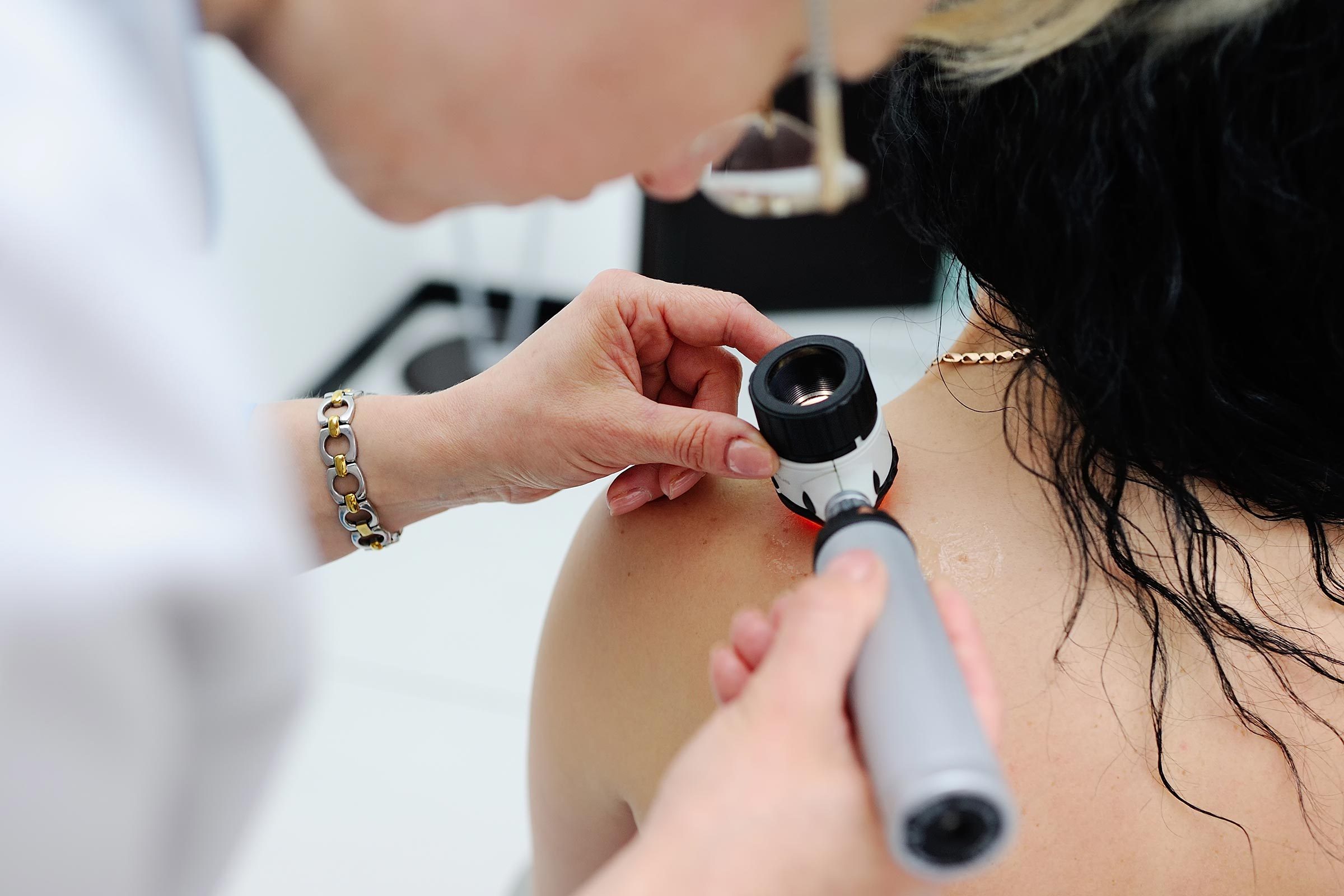 doctor examining skin for signs of skin cancer