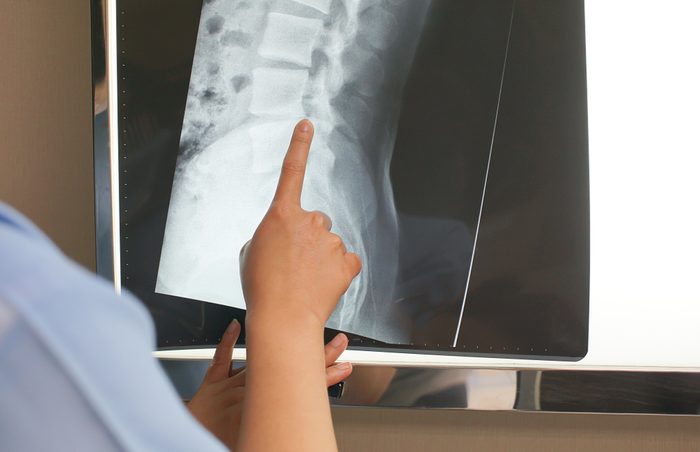 closeup of professional doctor examining x-ray film of patient. medical and healthcare concept.