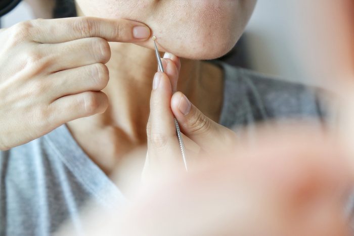 Woman uses her hand to squeeze pimples on her face in front of mirror with needle. Concept of skin care, acne treatment equipment, pop pimples.