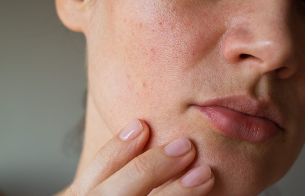 woman with fingers on her chin