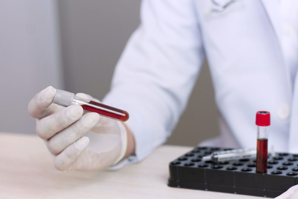 science, chemistry, biology, medicine and people concept - close up of young female holding tube with blood sample making and test or research in clinical laboratory