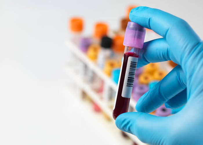 technician holding a blood sample tube