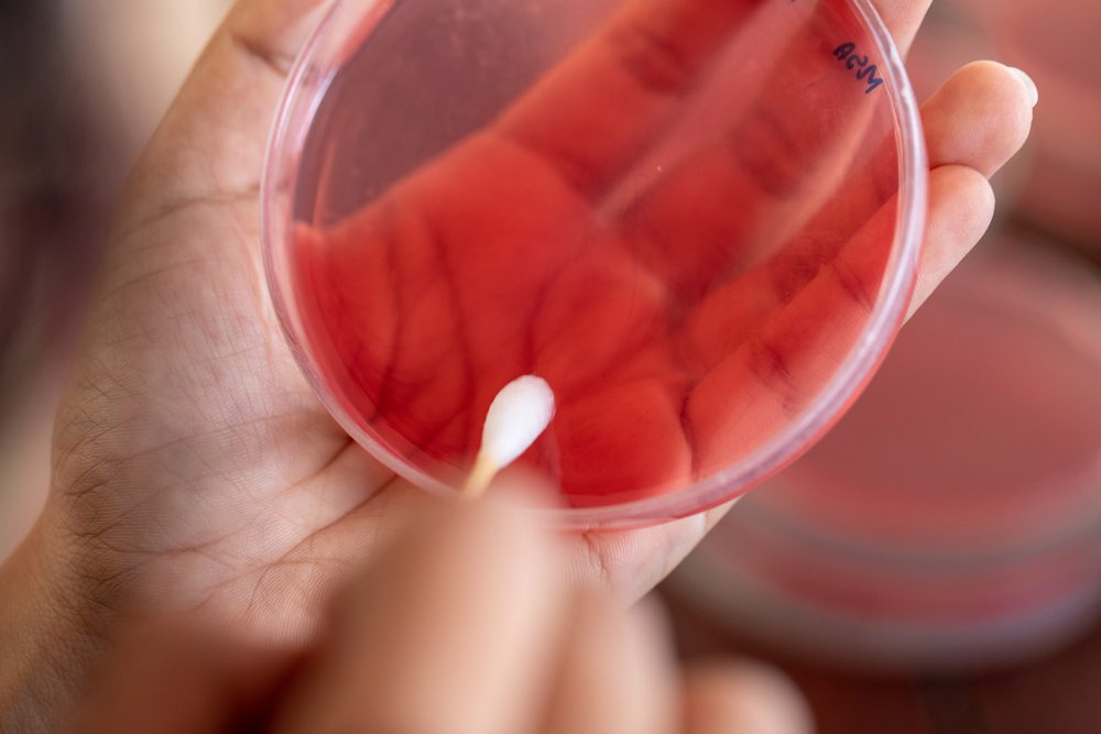 Study for Bacteria (Staphylococcus aureus) in the human nose, for study on Blood Agar Culture Plate in Lab Microbiology.