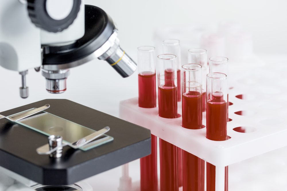 blood in glass tubes on background of microscope