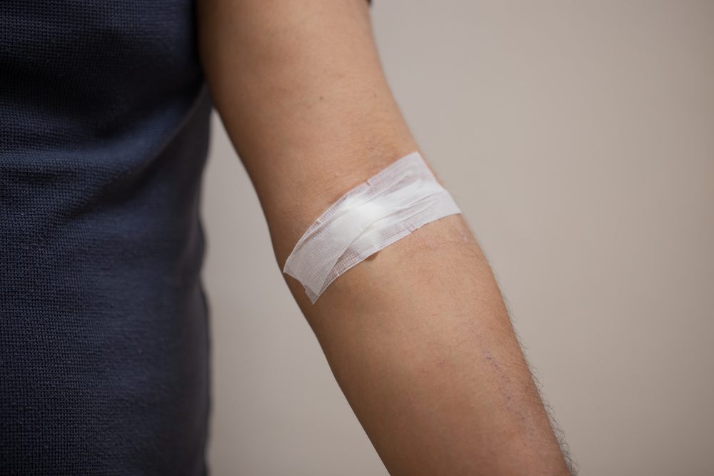 cotton closed on men arm after blood samples for examination 