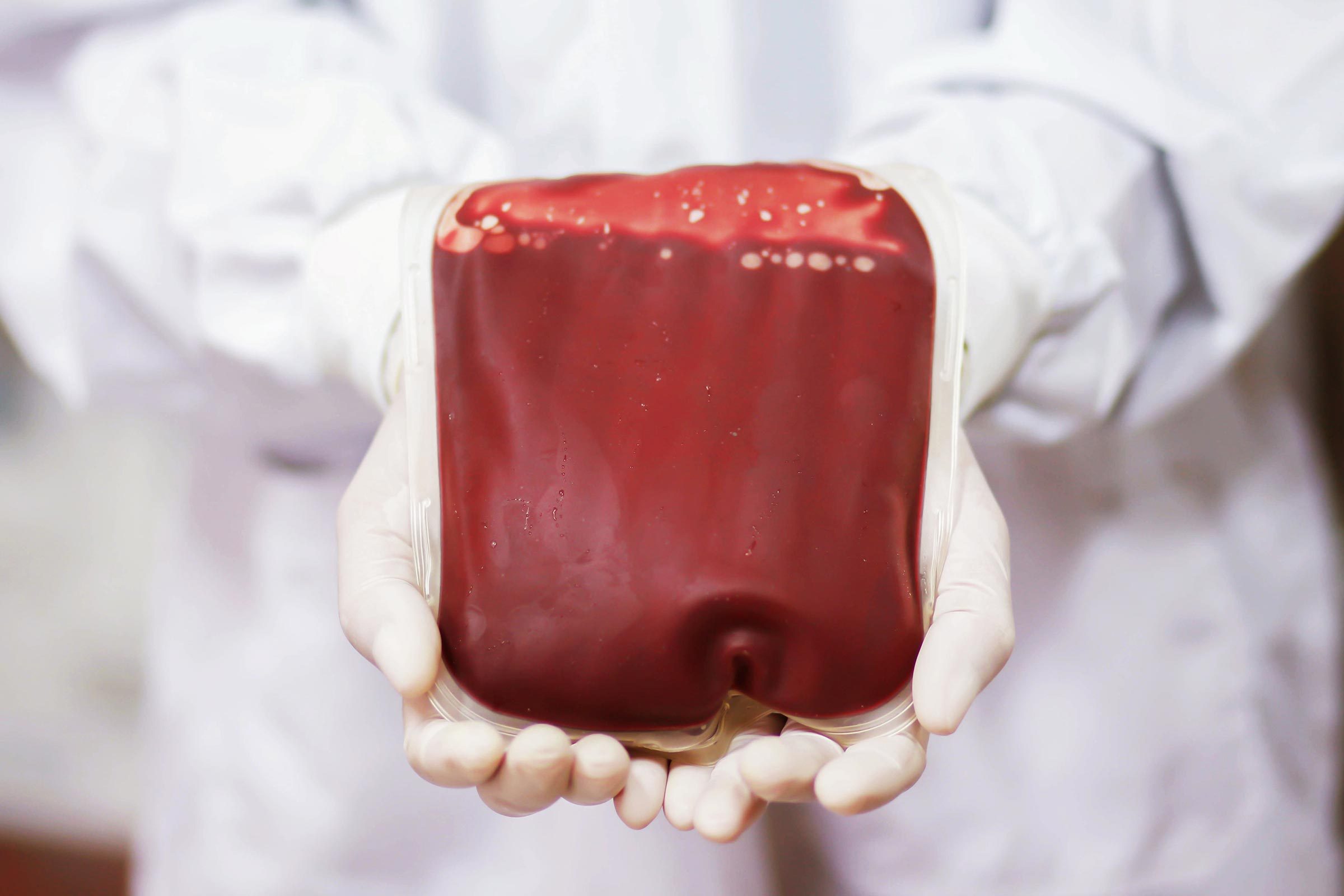 13 Common Infections That Can Raise Your Heart Attack Risk