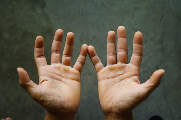 closeup of open hands overhead view