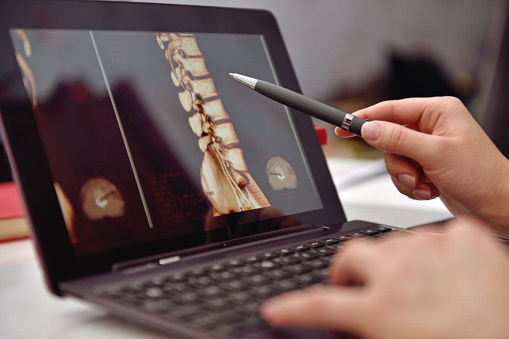 Doctor Pointing to X-ray Of Patient On Laptop Screen. Close Up