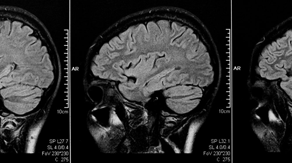 magnetic resonance tomography