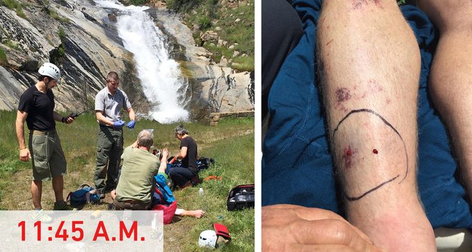 Medics arrive at the scene of snake bite.