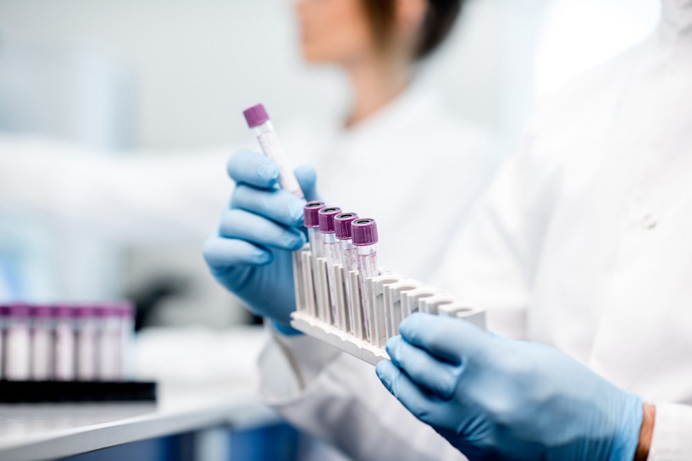 Laboratory assistant putting test tubes into the holder, Close-up view focused on the tubes