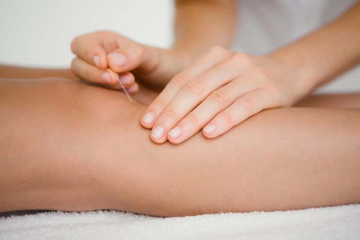person inserting acupuncture needle into leg
