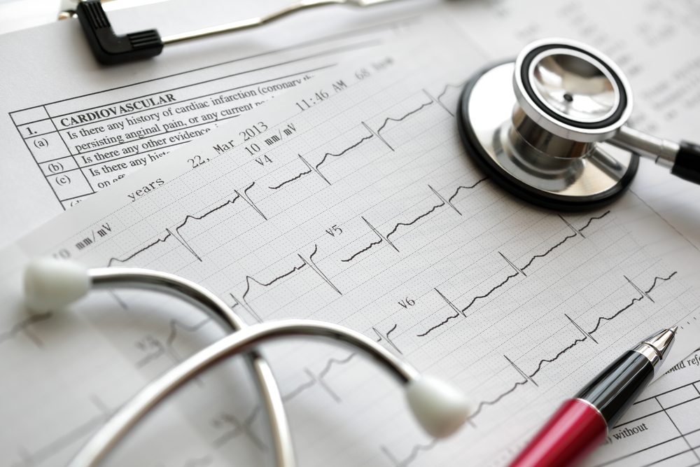 Cardiogram pulse trace and stethoscope concept for cardiovascular medical exam