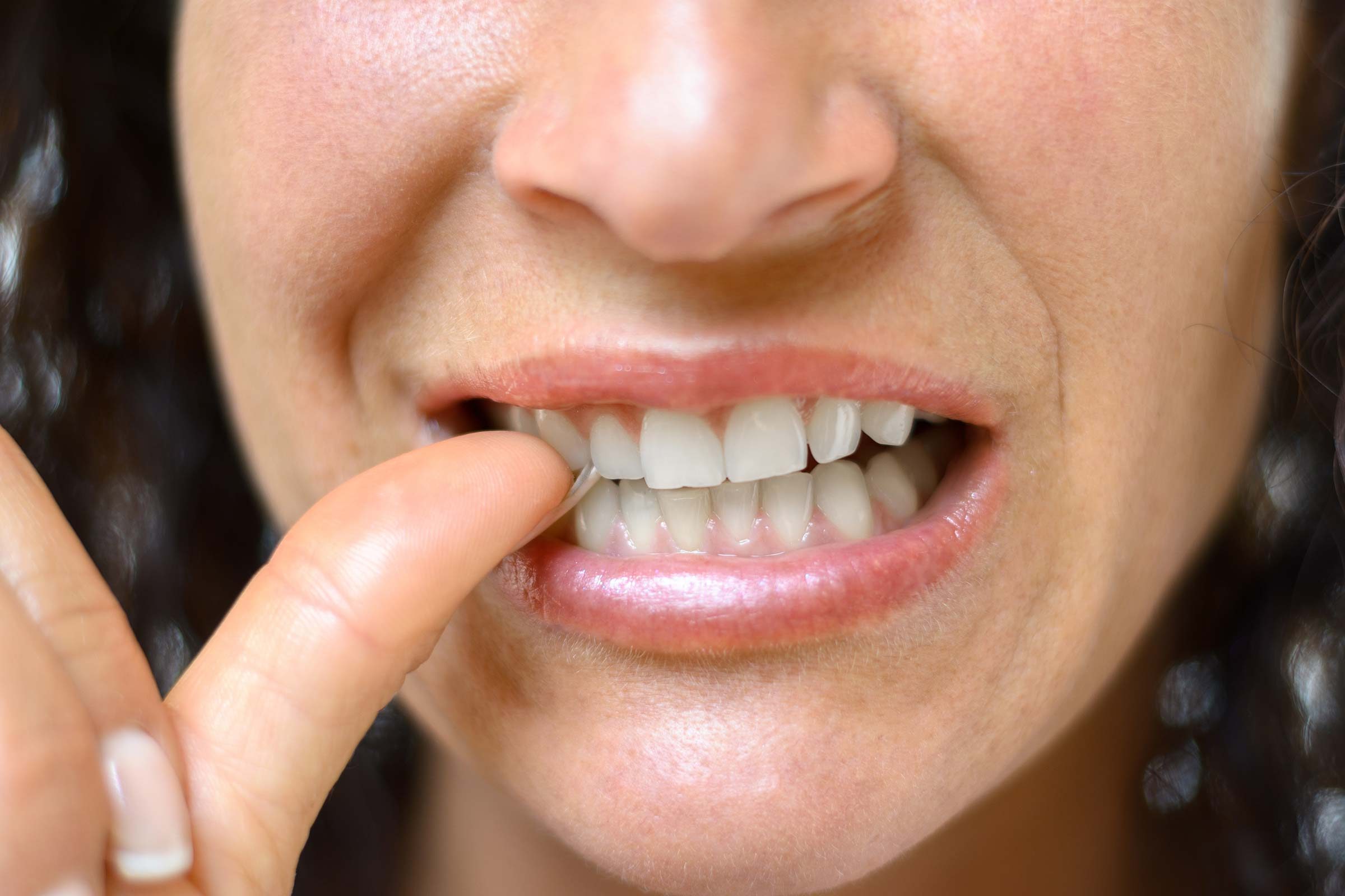 woman biting her thumbnail