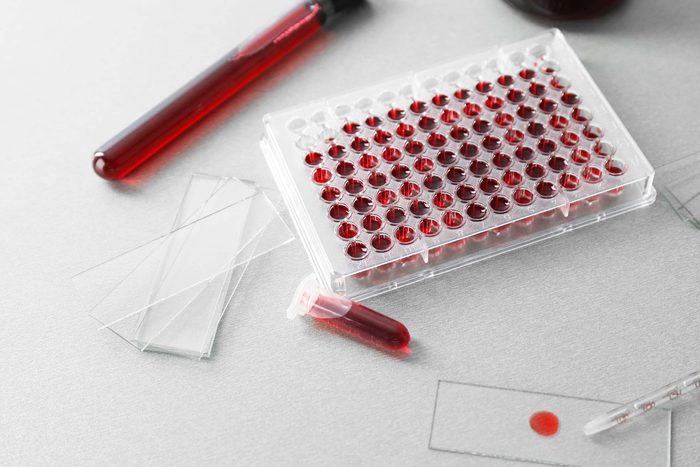 a tray and test tube full of blood samples