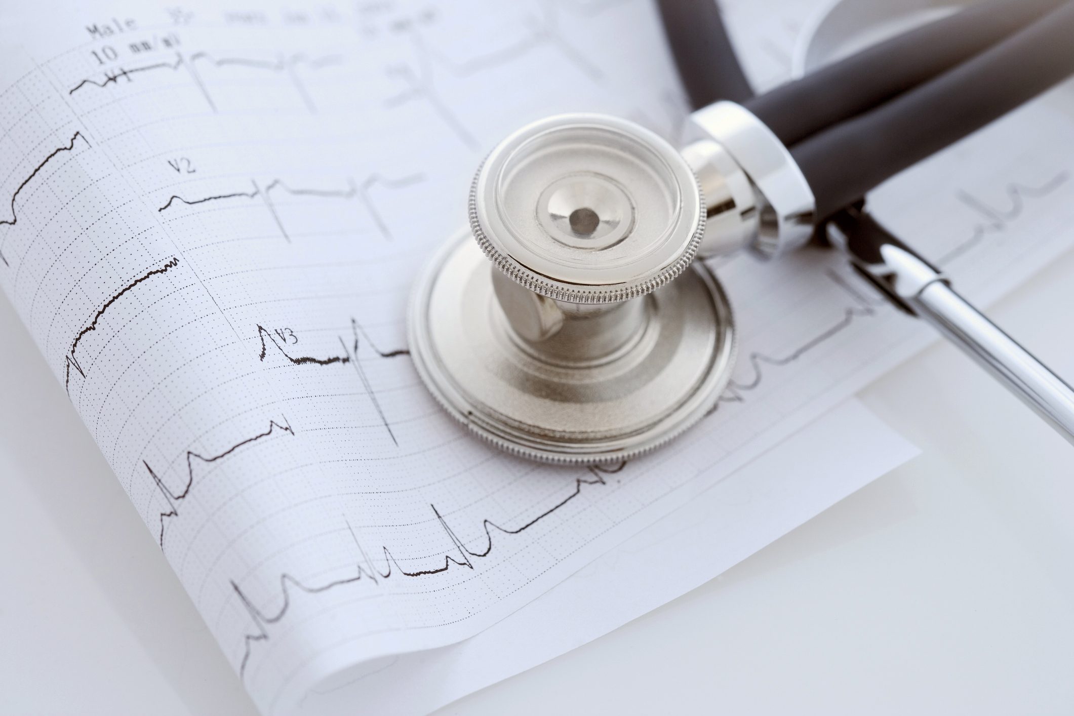 close up of stethoscope and heart scan