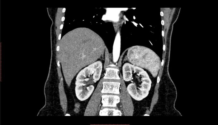 Abdomen Imaging of Human Body with Computed Tomography (CT)