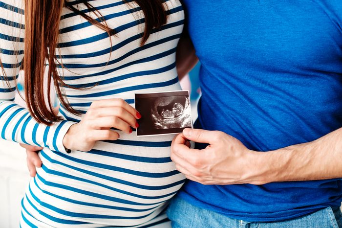 Pregnant woman and her husband holding ultrasound