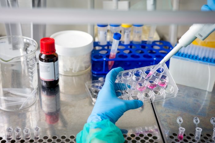 Pipetting and preparing samples in cancer research laboratory