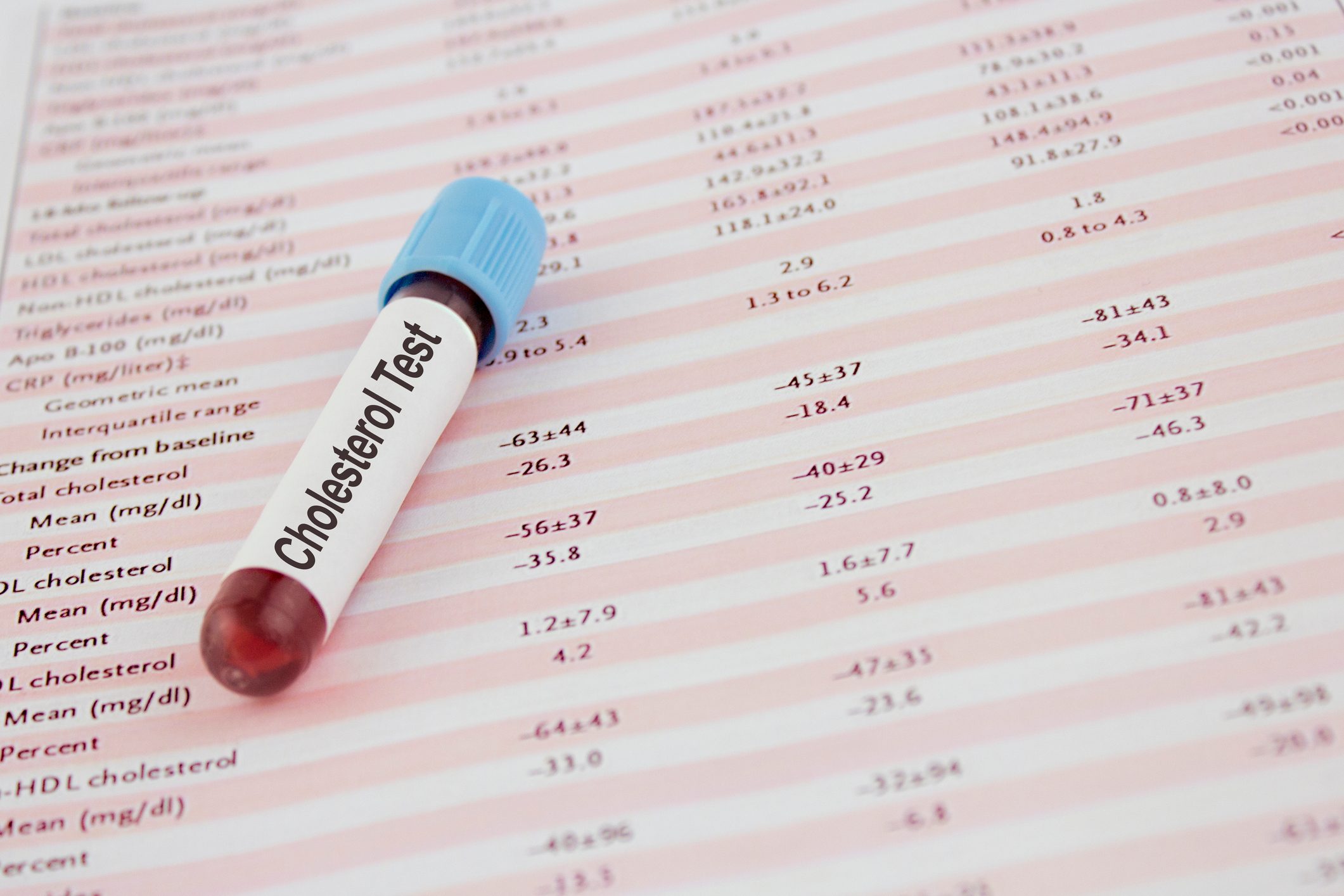 cholesterol blood test result