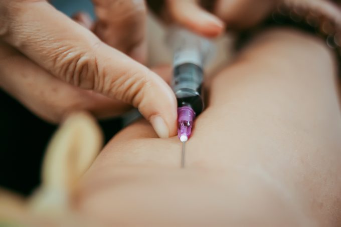 Close up pricking needle syringe in the arm blood sample for blood test.; Shutterstock ID 1096691849