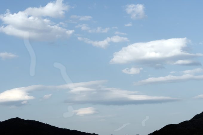 floaters eye squiggly lines vision