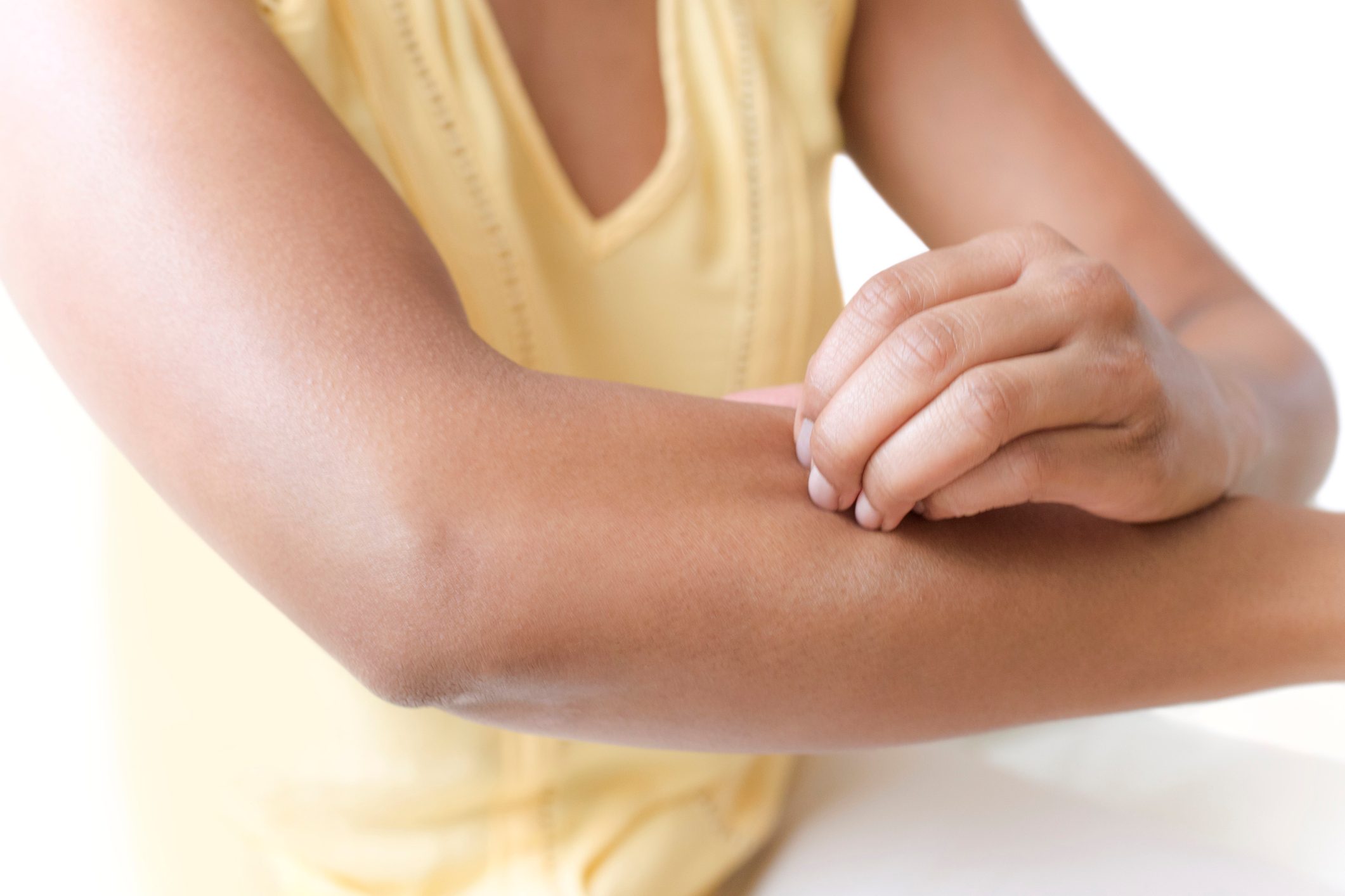 close up of woman scratching arm