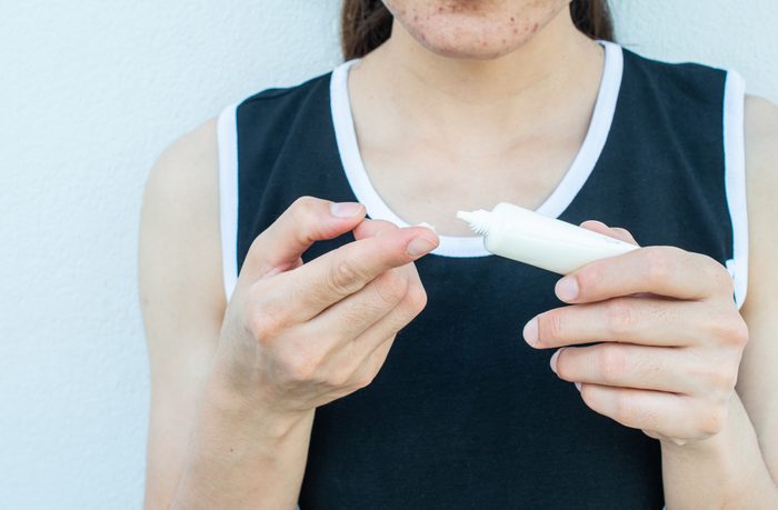 Cropped shot view of woman with acne inflammation (Papule and Pustule) on her face and she trying to applying acne cream on her face for treat.