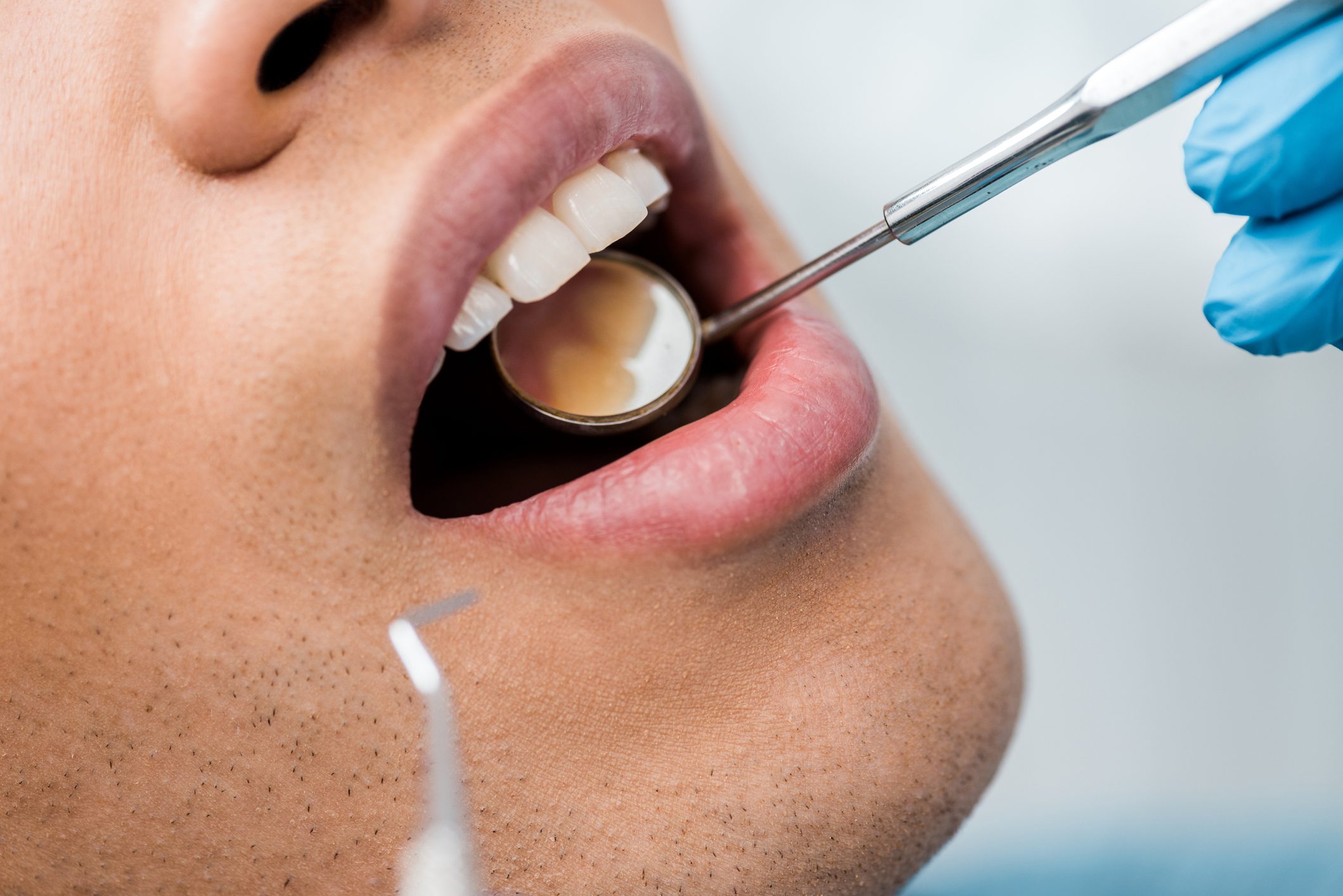 cropped view of man with medical instrument in open mouth