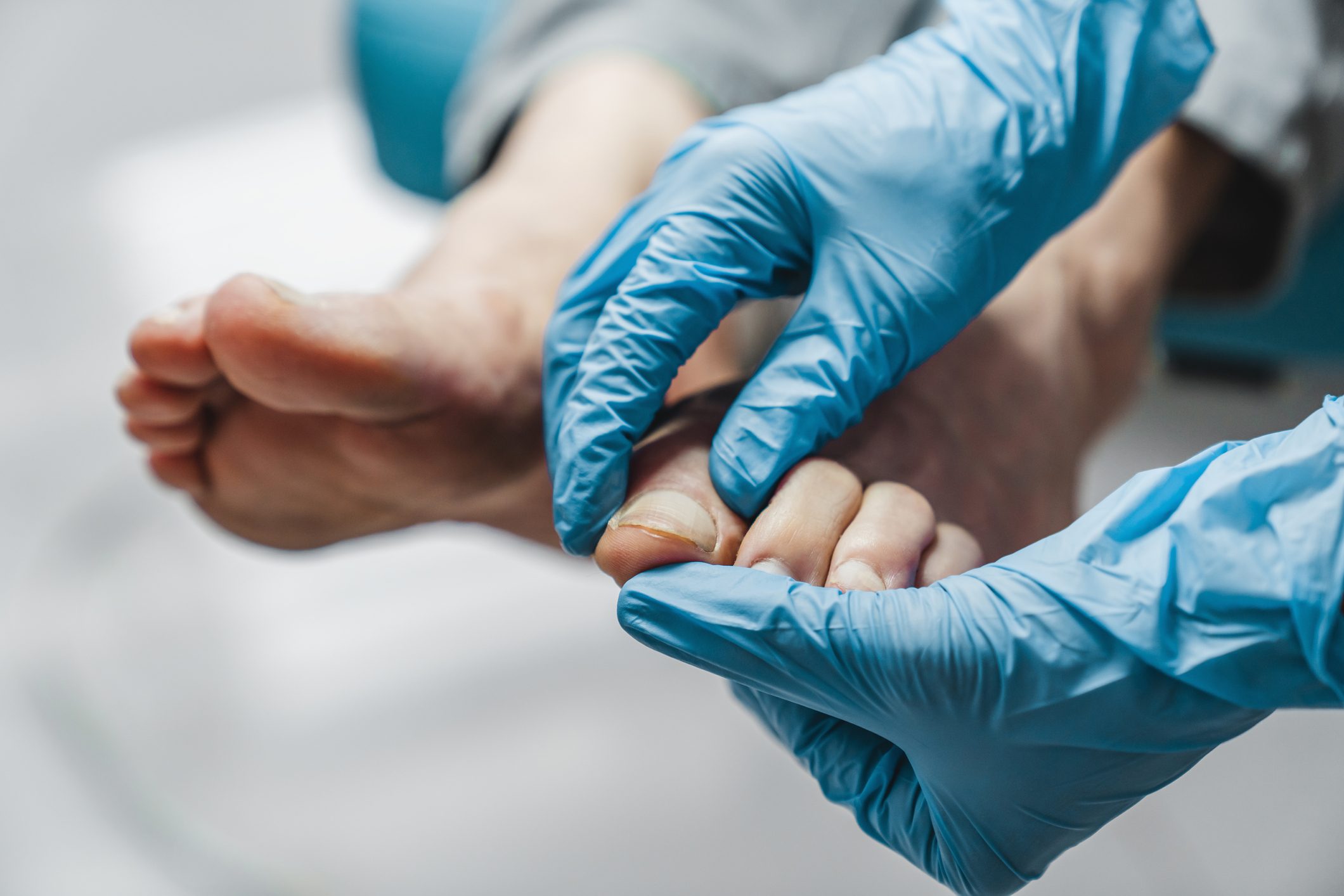 Podiatrist treating feet during procedure