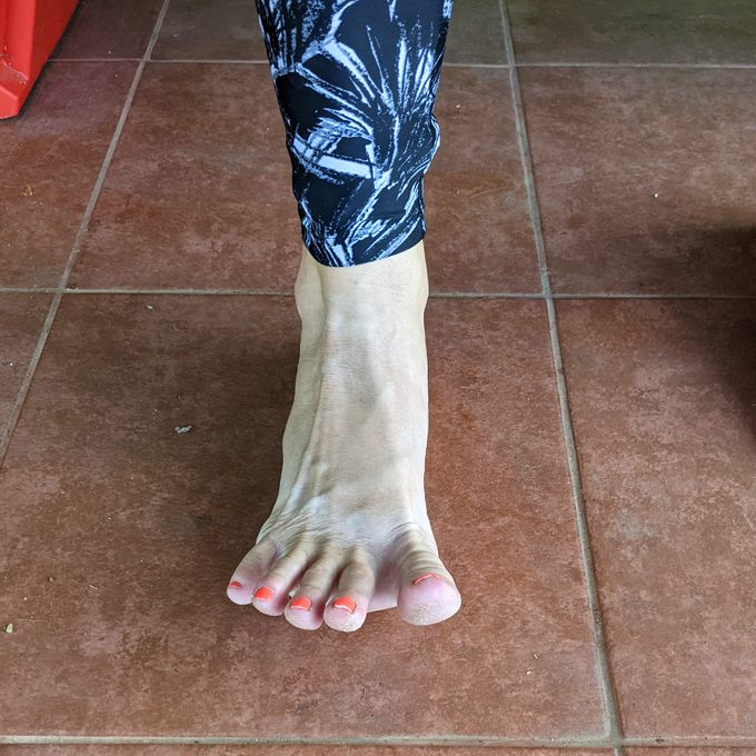 Toe Spread Outs Bunion Exercise