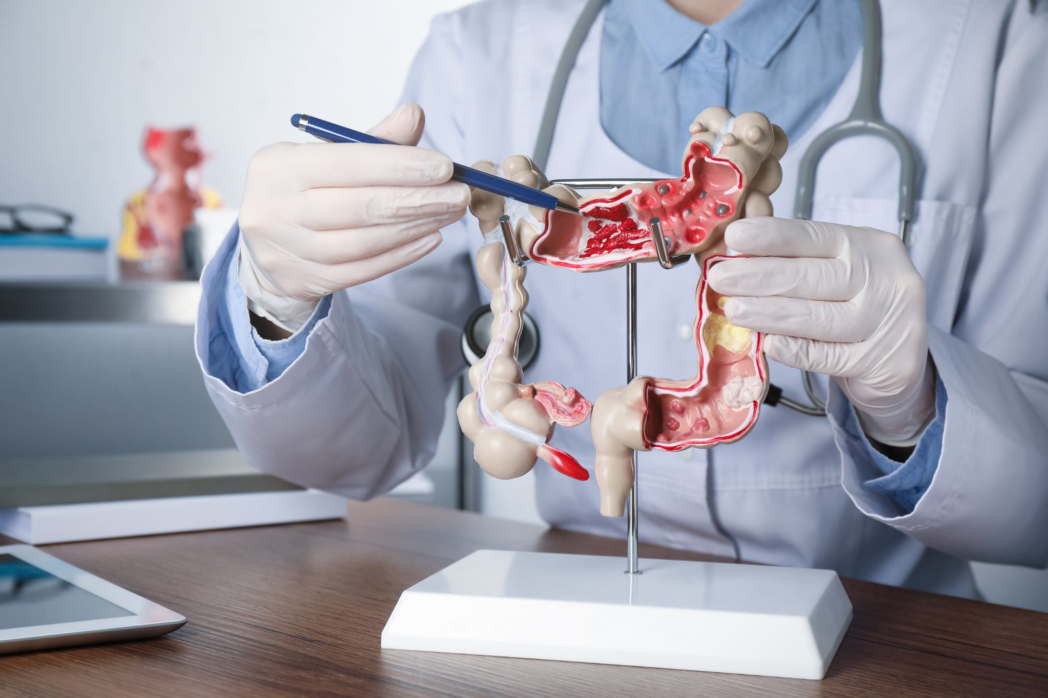 anonymous gastroenterologist pointing to a model colon in a doctors office