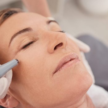 Closeup shot of a mature woman enjoying a micro-needling treatment at a spa