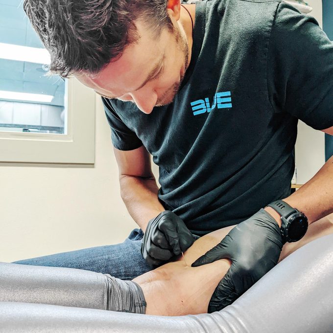 close up of dry needling