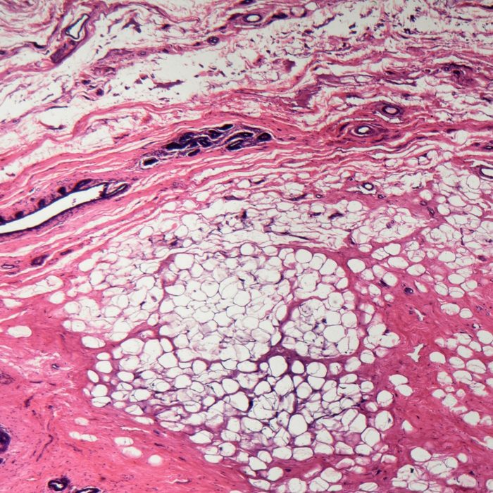 Human mammary gland cells under the microscope