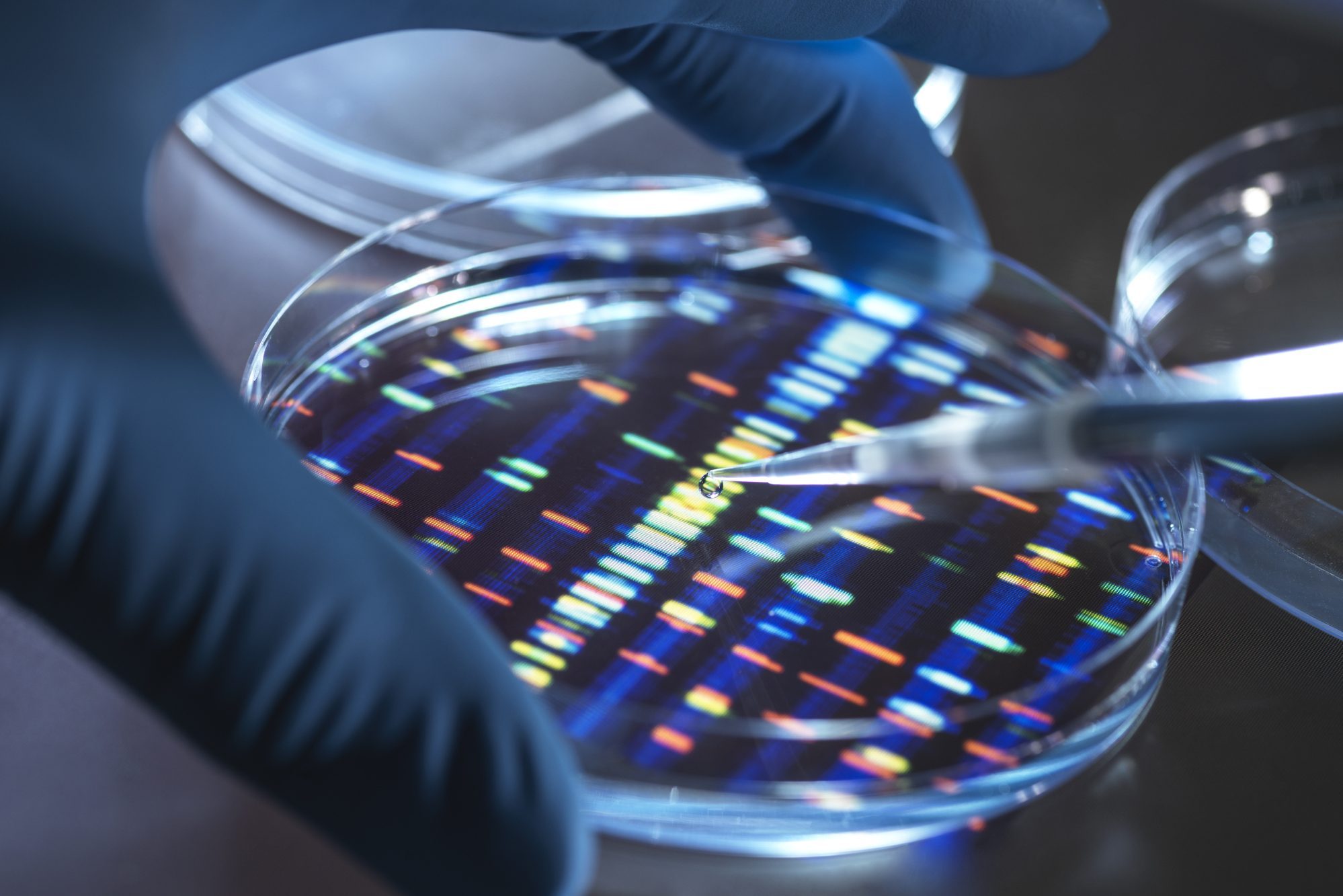 Scientist pipetting sample into tray for DNA testing in laboratory